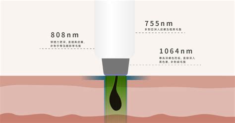 激光脫陰毛|激光脫毛副作用及原理全解構 